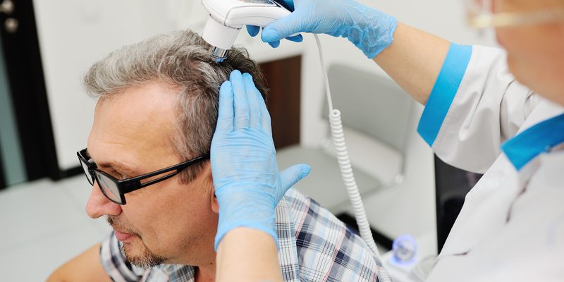 hair_55 Hair loss treatment